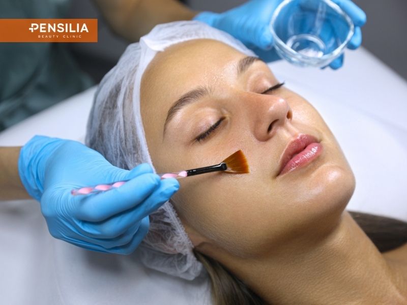 Bác sĩ da liễu Pensilia thực hiện thao tác peel da trị nám chuẩn y khoa cho khách hàng.