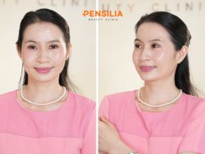 Kết quả điều trị tại PENSILIA