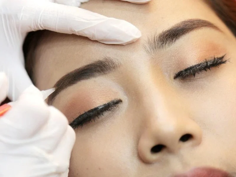 Vì sao xóa xăm lông mày bằng phương pháp cũ dễ để lại sẹo?