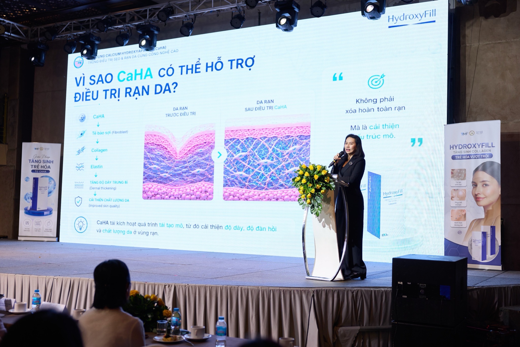 Ứng dụng Calcium Hydroxyapatite (CaHA) trong điều trị sẹo và rạn da kết hợp công nghệ cao có bác sĩ thảo tham gia