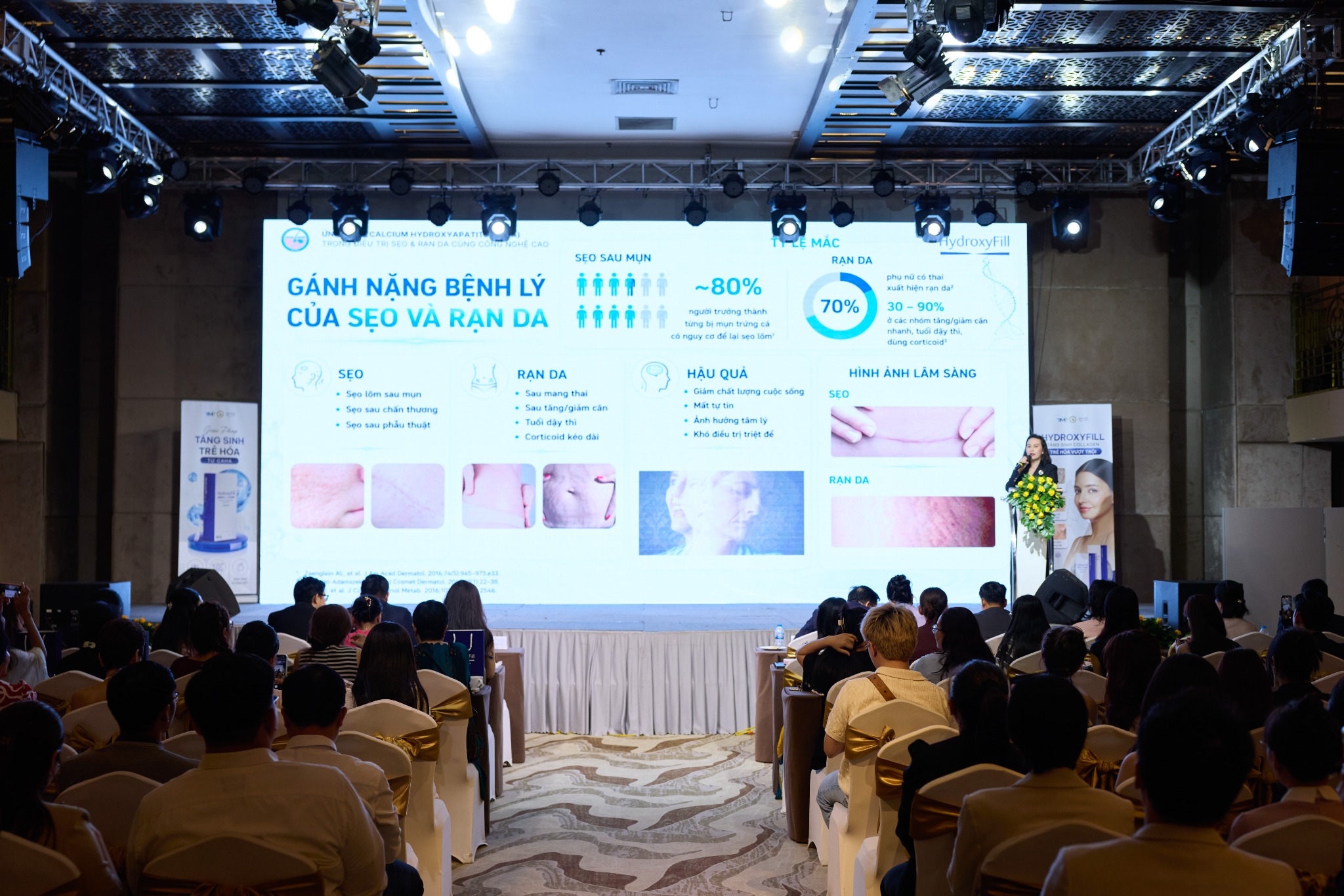 Ứng dụng Calcium Hydroxyapatite (CaHA) trong điều trị sẹo và rạn da kết hợp công nghệ cao