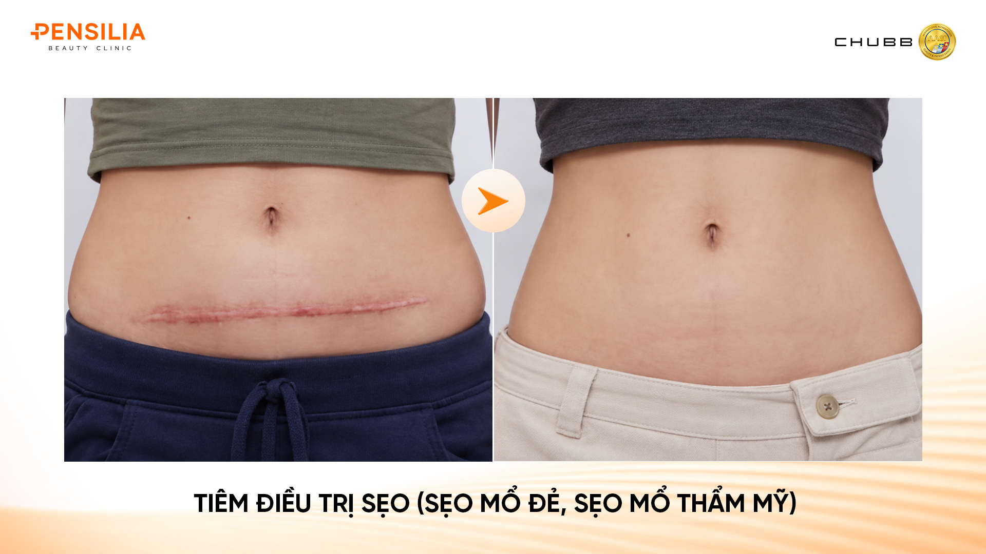 trị sẹo mổ INBIOTEC AMBER – "SKIN BUILDER" THẾ HỆ MỚI: PHỤC HỒI DA TỪ GỐC, CĂNG BÓNG TỰ NHIÊN
