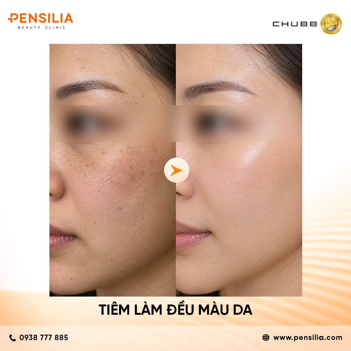 before after triêm làm đều màu da