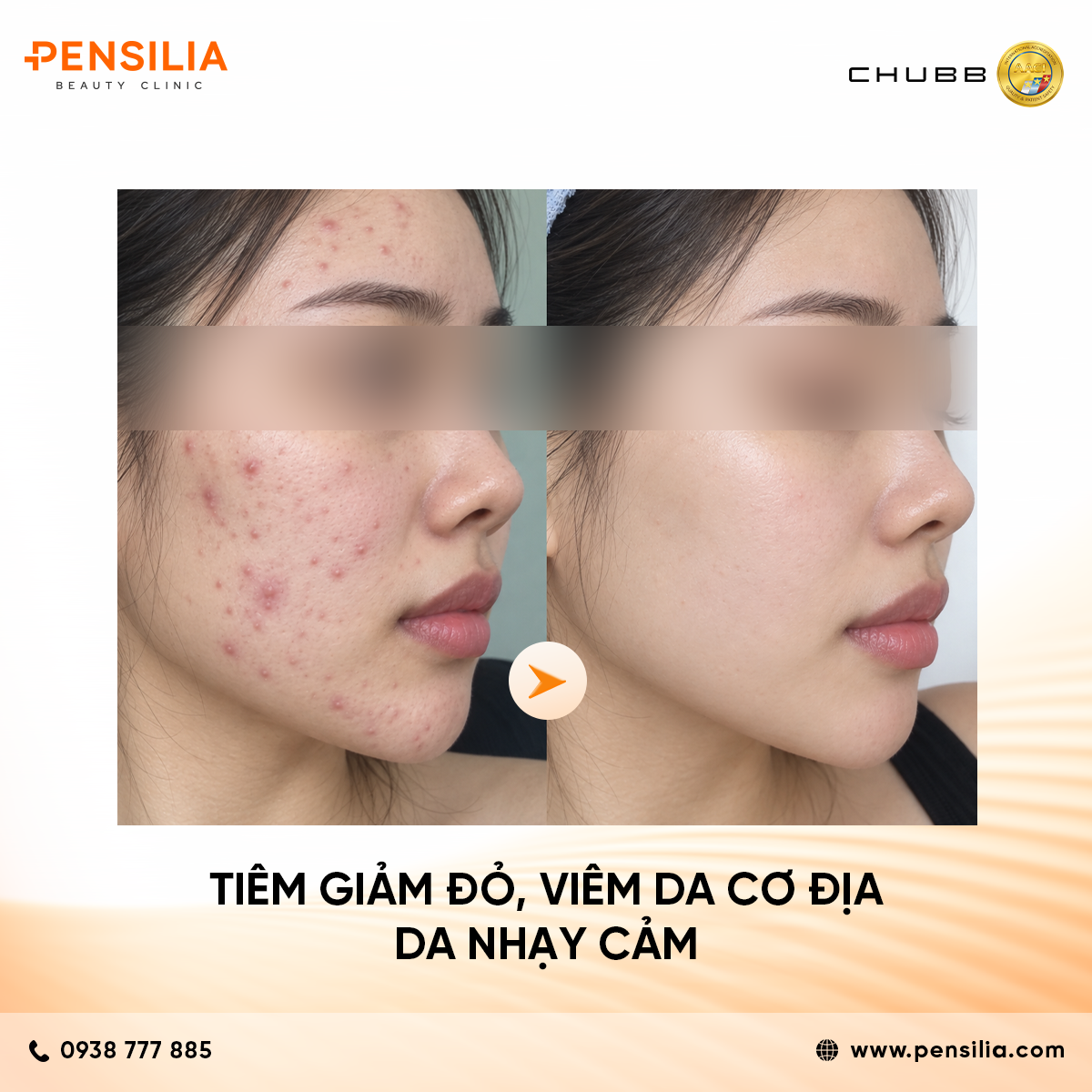 trẻ hoá vùng cổ INBIOTEC AMBER – "SKIN BUILDER" THẾ HỆ MỚI: PHỤC HỒI DA TỪ GỐC, CĂNG BÓNG TỰ NHIÊN
