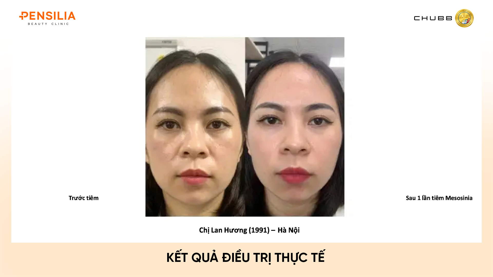 INBIOTEC AMBER – "SKIN BUILDER" THẾ HỆ MỚI: PHỤC HỒI DA TỪ GỐC, CĂNG BÓNG TỰ NHIÊN thực tế