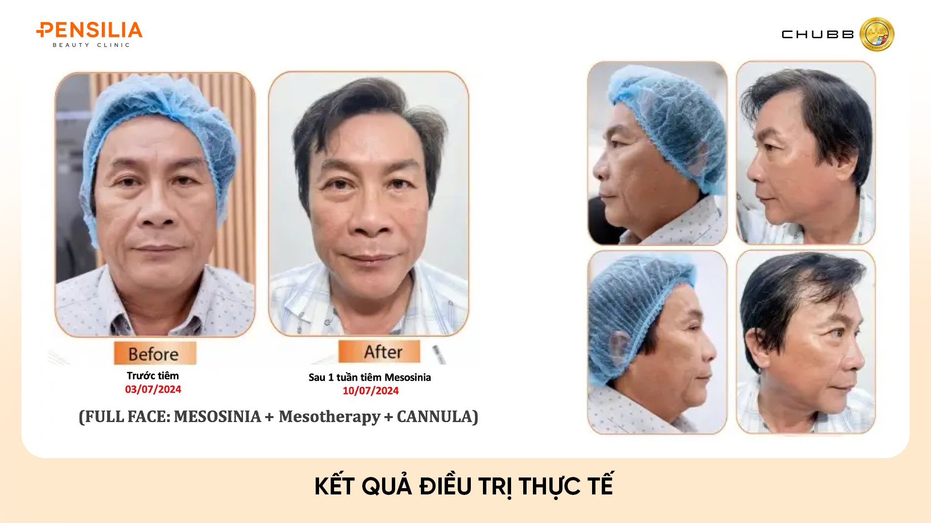INBIOTEC AMBER – "SKIN BUILDER" THẾ HỆ MỚI: PHỤC HỒI DA TỪ GỐC, CĂNG BÓNG TỰ NHIÊN
