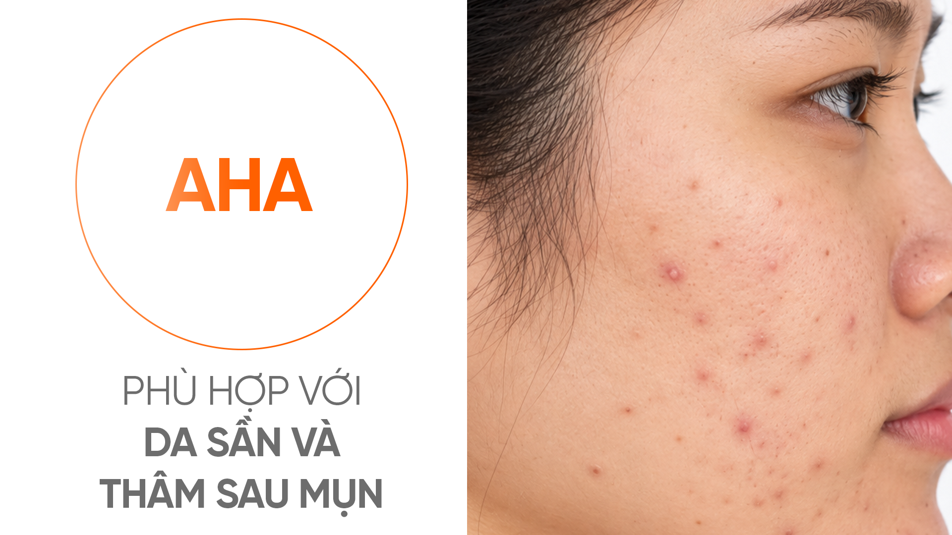 BHA, AHA và Retinol là gì
