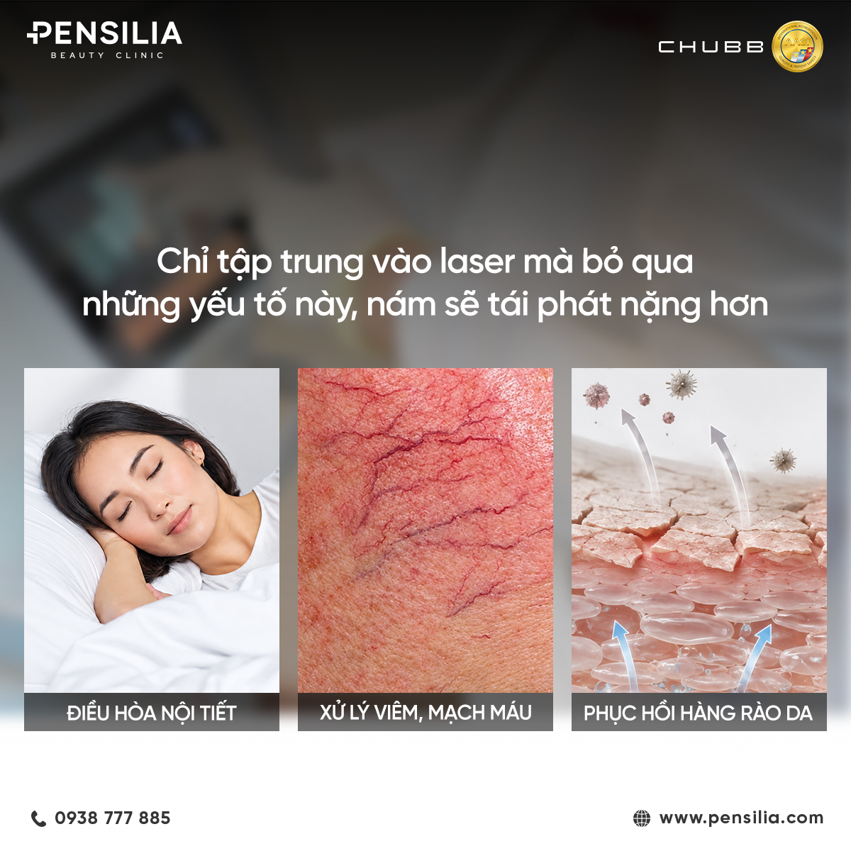 Các yếu tố nguyên nhân khiến nám da tái phát bao gồm nội tiết, tổn thương mạch máu và suy giảm hàng rào bảo vệ da.
