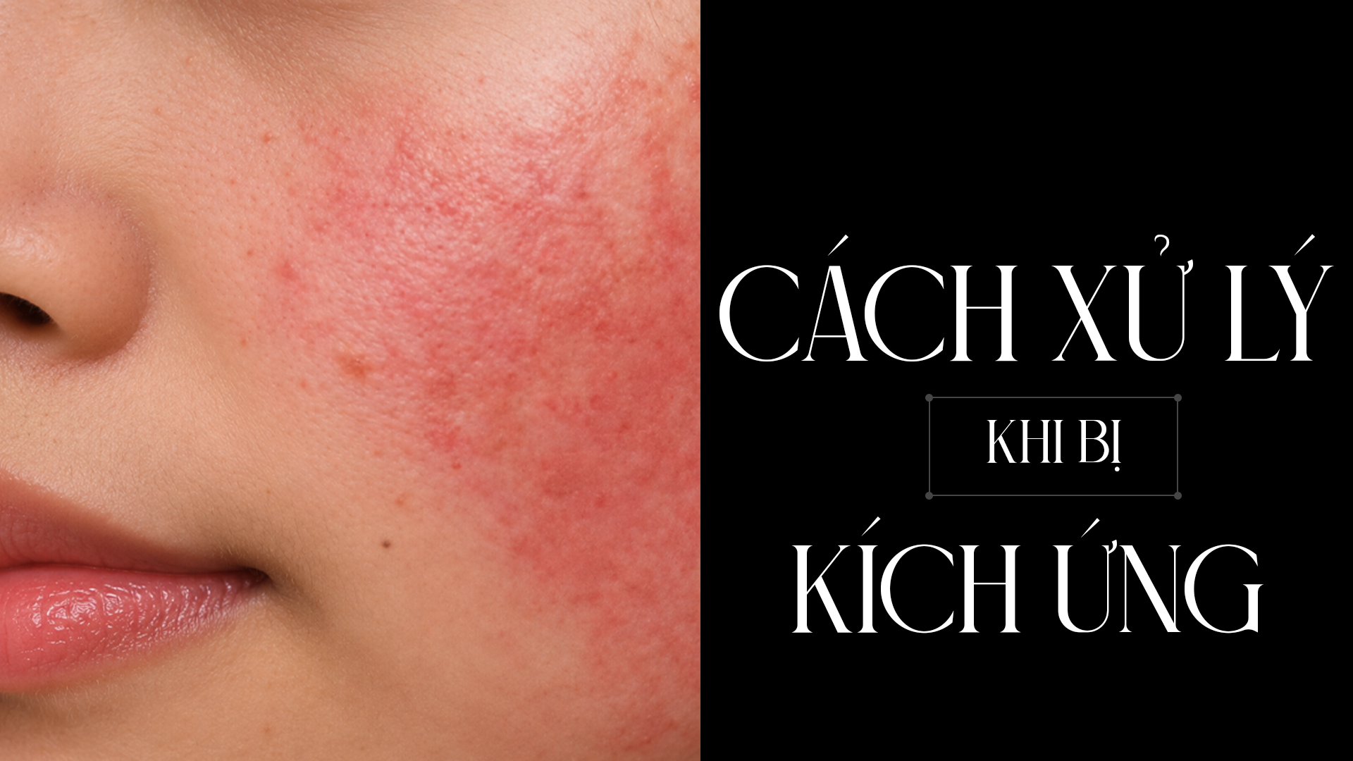 cách xử lý cách dùng an toàn Ceramide và retinol có dùng chung được không