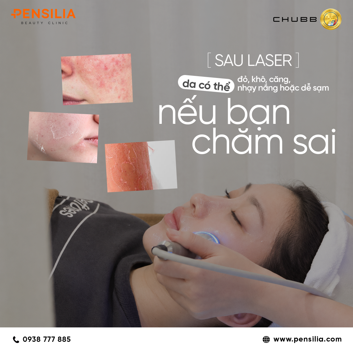 Các biểu hiện đỏ rát, khô căng và dễ sạm nám nếu chăm sóc da sau laser sai cách.