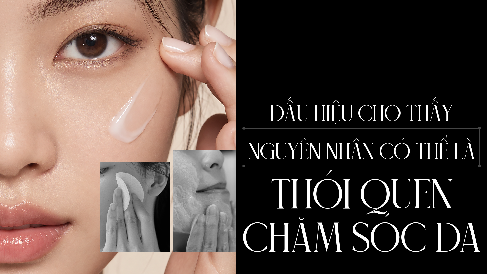 dấu hiệu Nguyên nhân tổn thương hàng rào da và cách phòng ngừa