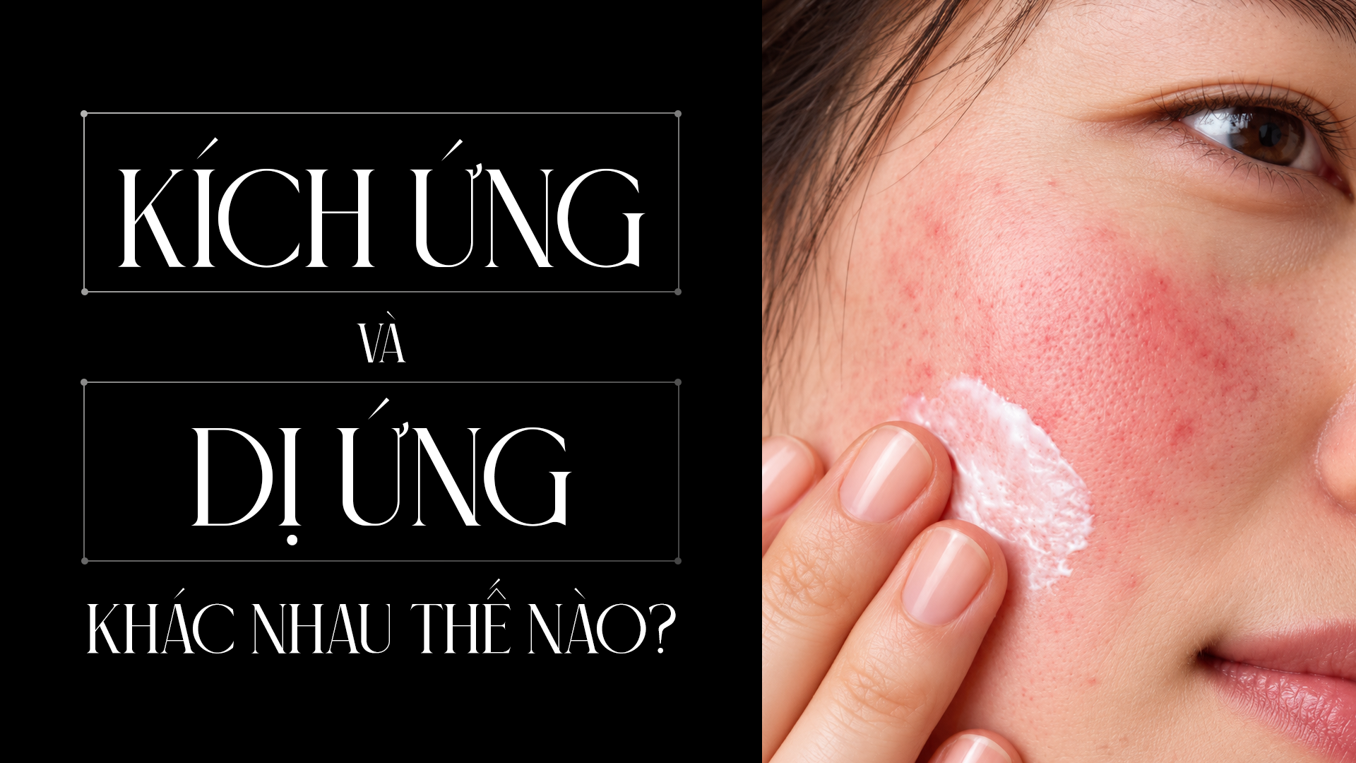 Kích ứng và dị ứng mỹ phẩm khác nhau thế nào