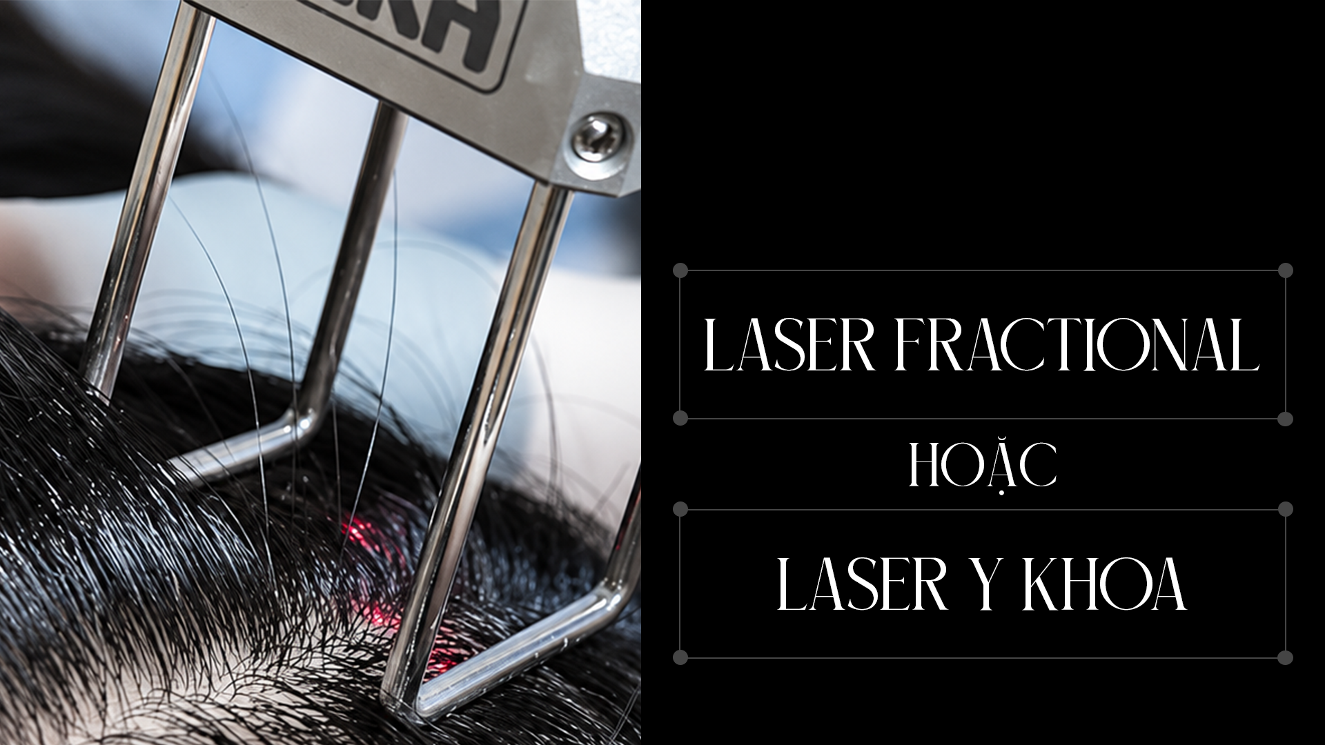 Laser fractional hoặc laser y khoa
