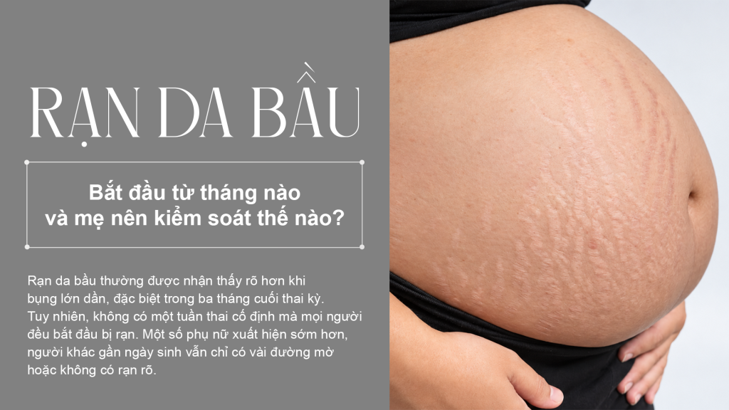 Rạn da bầu Bắt đầu từ tháng nào