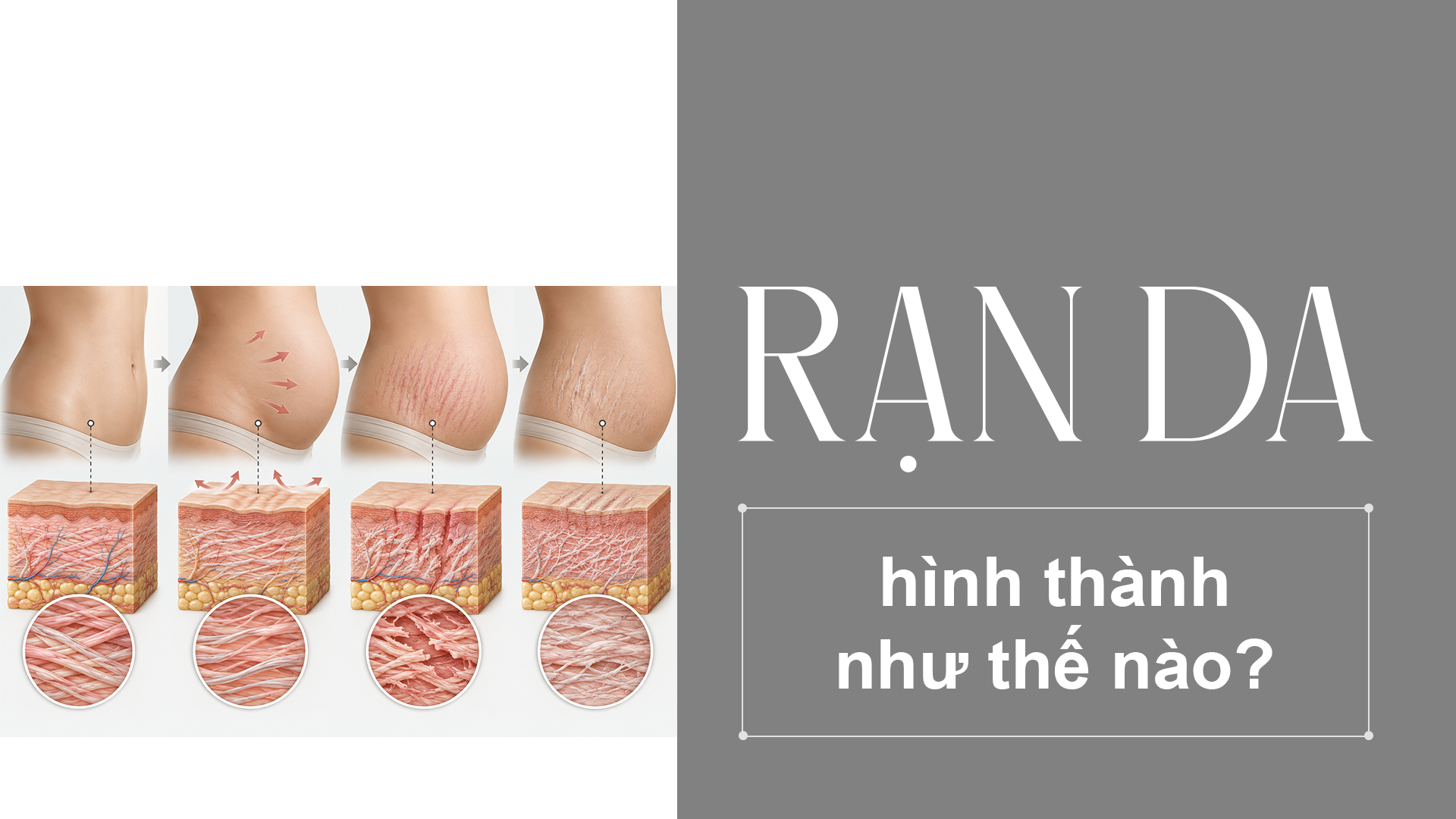 Rạn da hình thành như thế nào