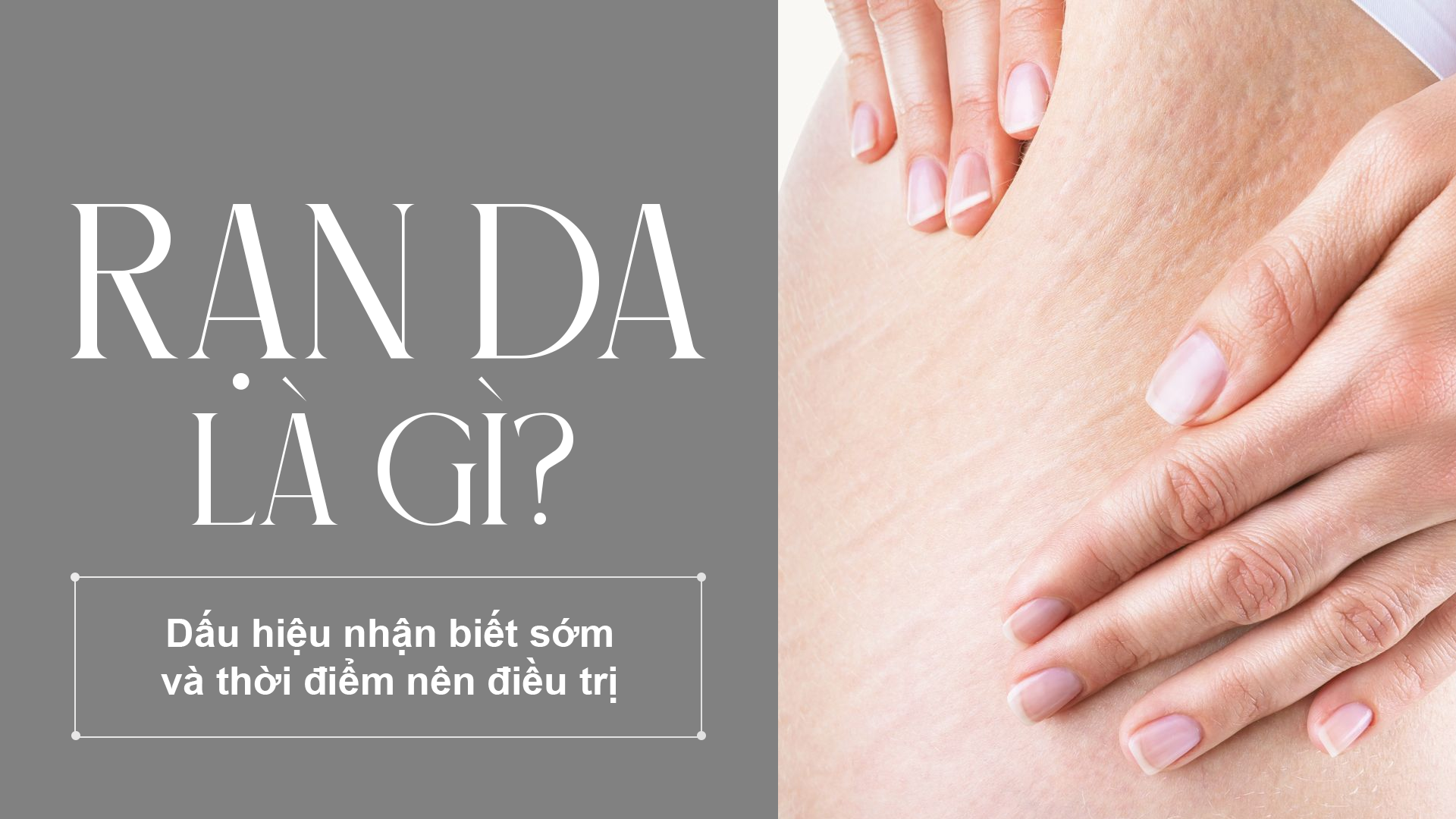 Rạn da là gì