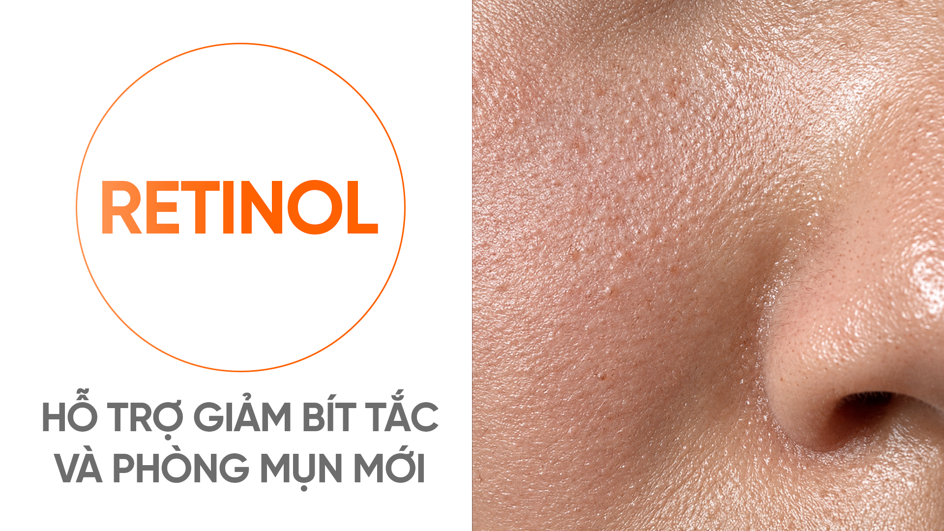 BHA, AHA và Retinol là gì