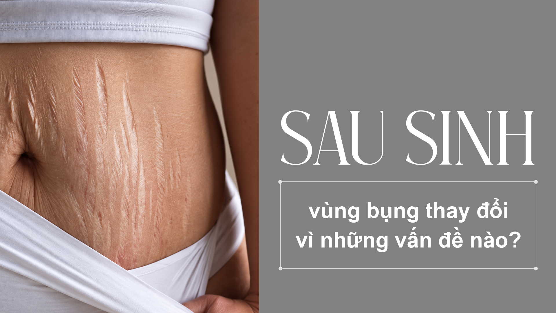 Sau sinh, vùng bụng thay đổi vì những vấn đề nào_