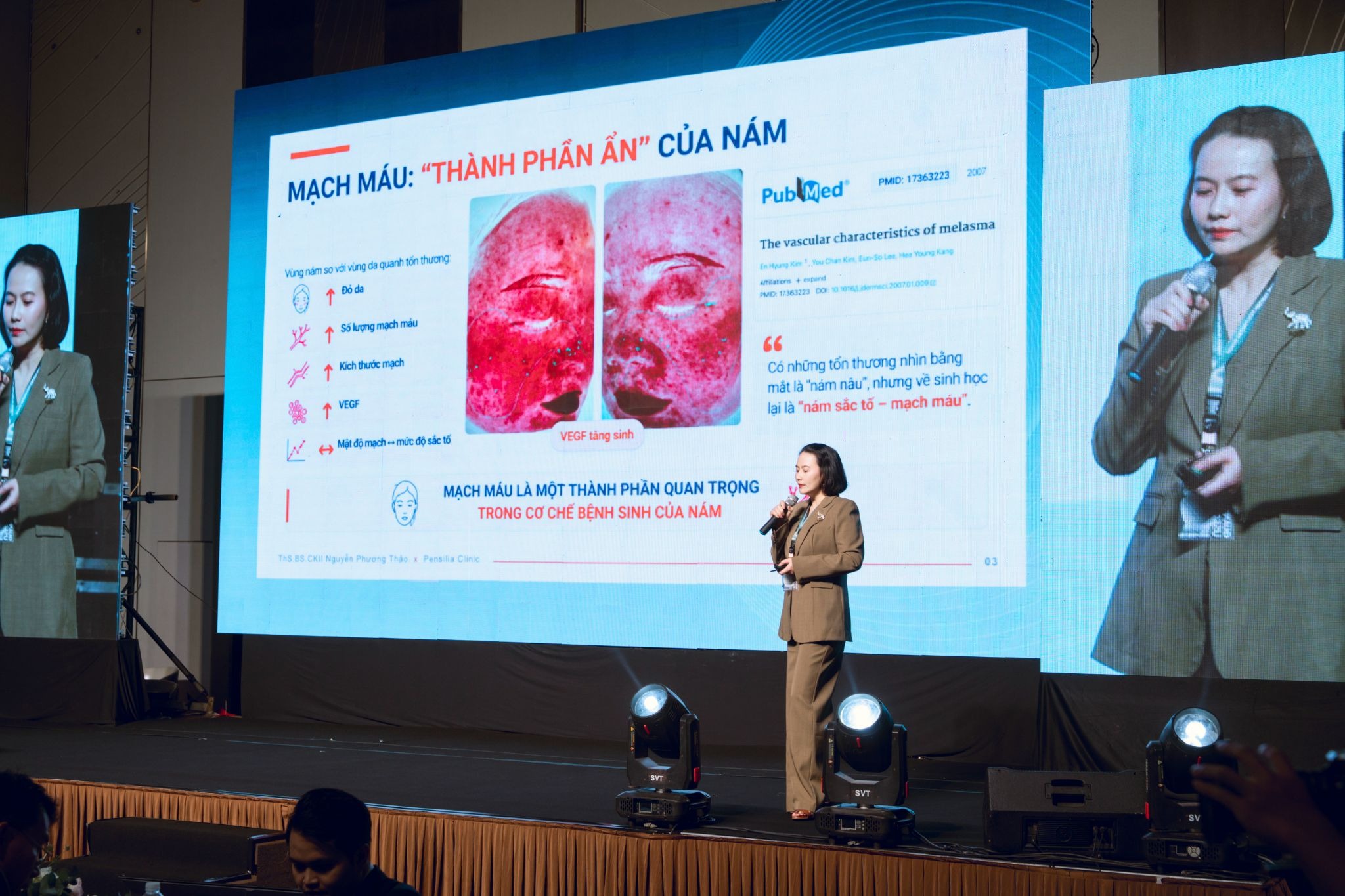 Sơ đồ ba kiểu hình nám trong bài báo cáo của bác sĩ Nguyễn Phương Thảo
