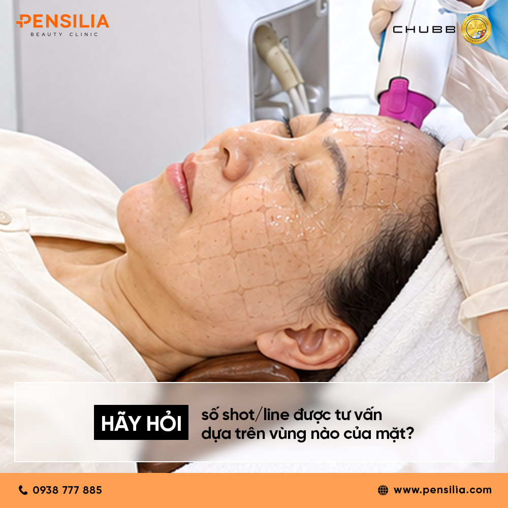 Cận cảnh khuôn mặt khách hàng được kẻ lưới định hình để tư vấn số shot và line khi làm Thermage HIFU.