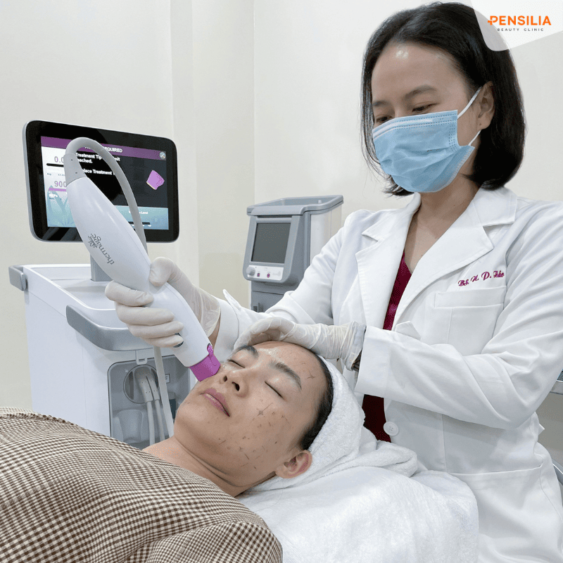 Bác sĩ đang thực hiện quy trình trẻ hóa da bằng công nghệ Thermage HIFU chính hãng tại Pensilia