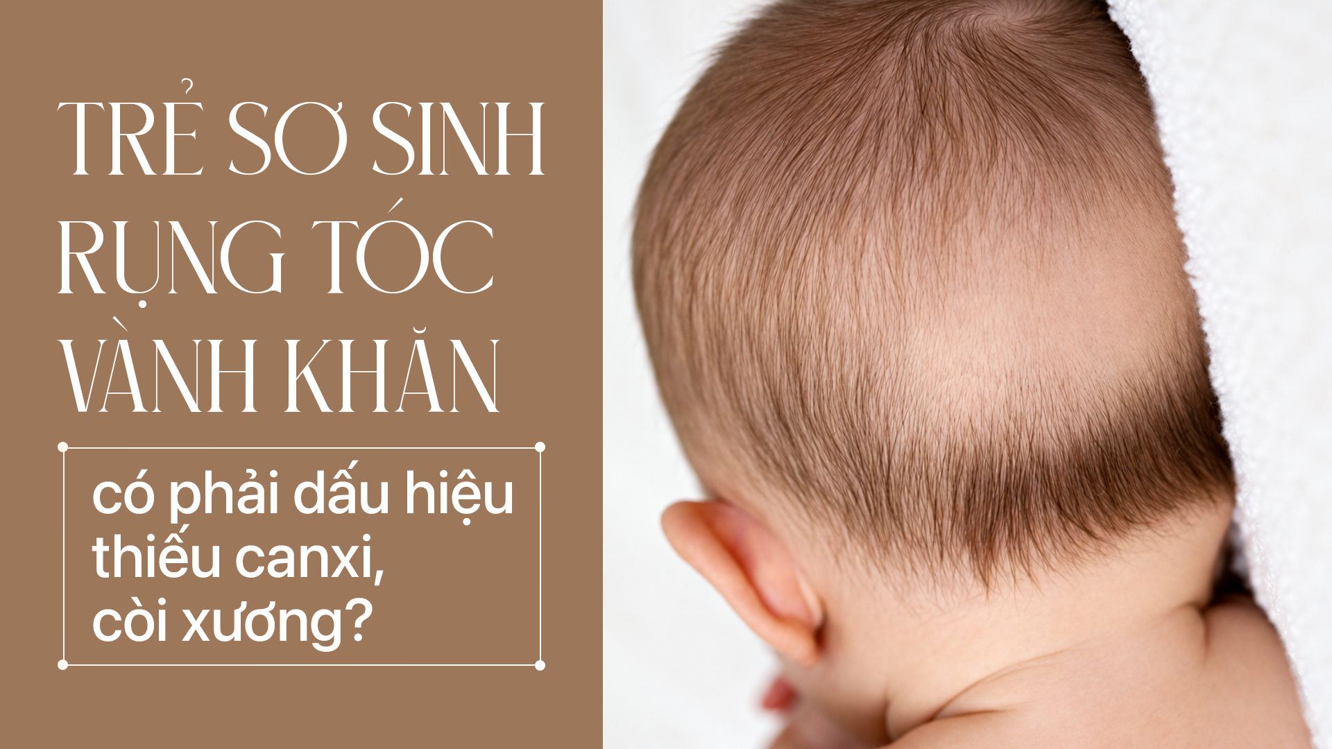 Trẻ Sơ Sinh Rụng Tóc Vành Khăn Có Phải Dấu Hiệu Thiếu Canxi, Còi Xương?