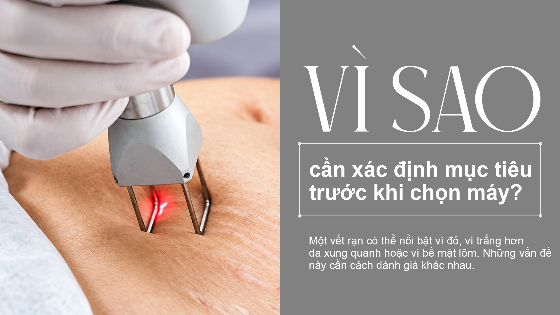 Vì sao cần xác định mục tiêu trước khi chọn máy