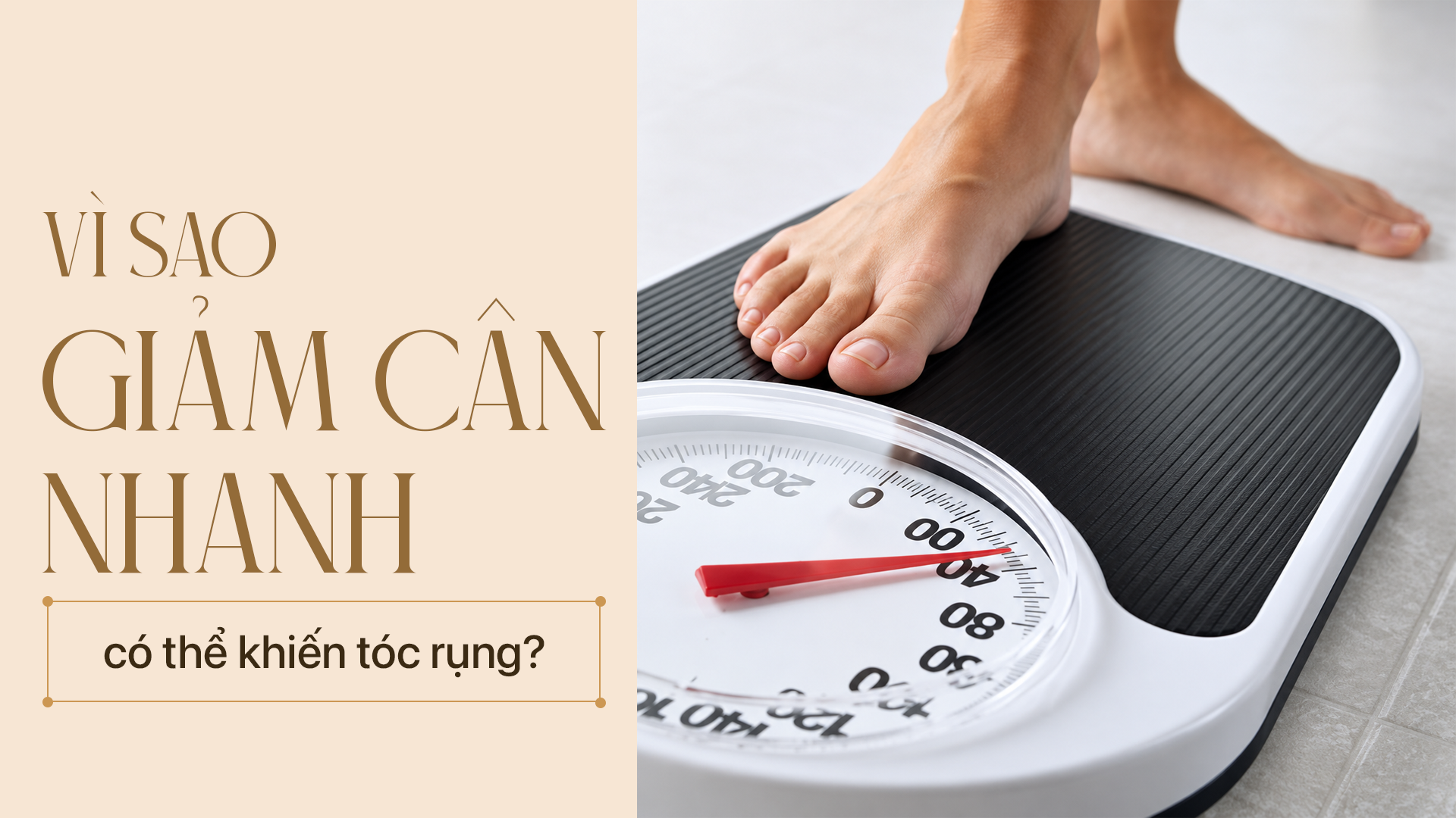 Vì sao giảm cân nhanh có thể khiến tóc rụng