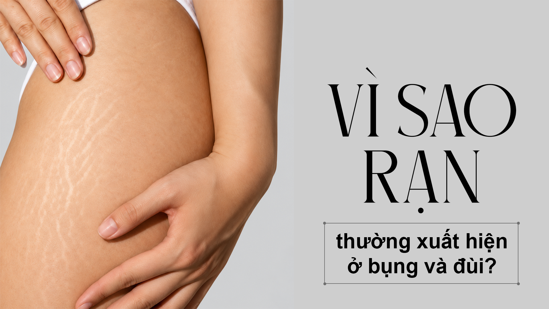 Vì sao rạn thường xuất hiện ở bụng và đùi