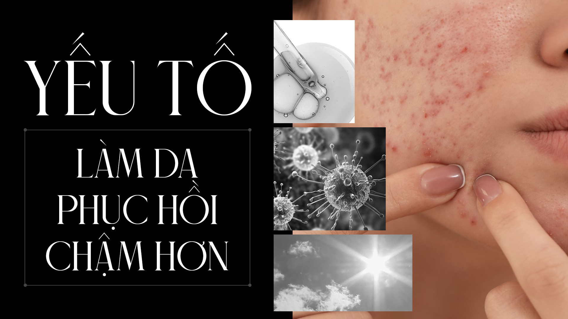Yếu tố làm da hồi phục chậm hơn